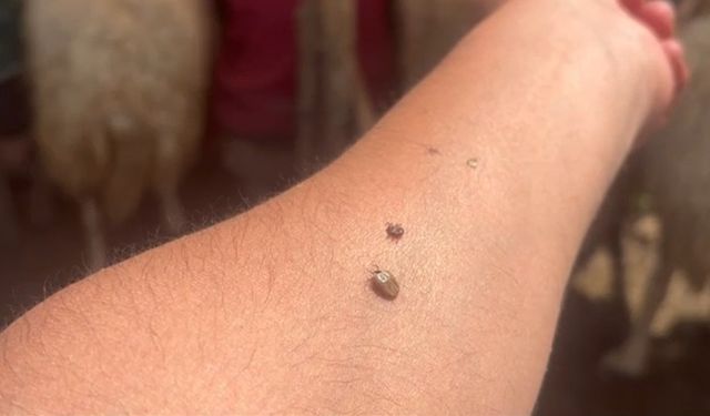 Erzincan’da KKKA uyarısı: Kene temasına karşı dikkatli olun!