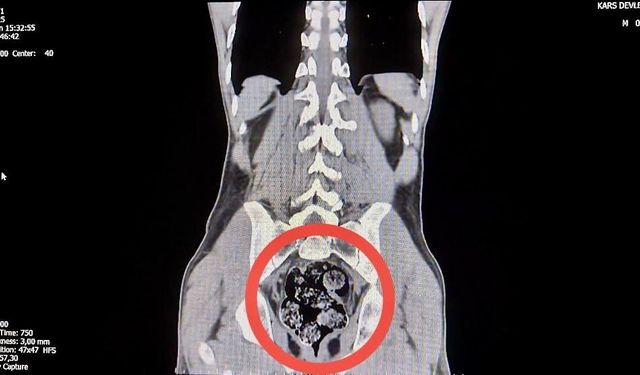 Kars’ta İranlı kuryenin makatından uyuşturucu çıktı